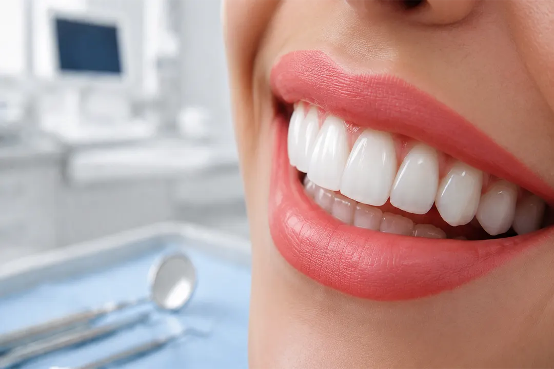 Dental laminate
