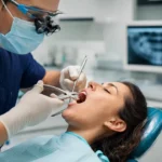 Wisdom tooth extraction 150x150
