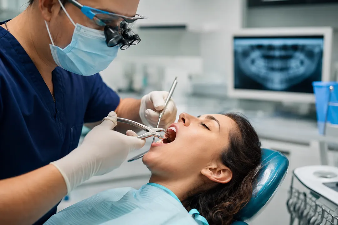 جراحی دندان عقل | هر آنچه باید بدانید 1 Wisdom tooth extraction