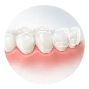 Invisible orthodontics 300x300