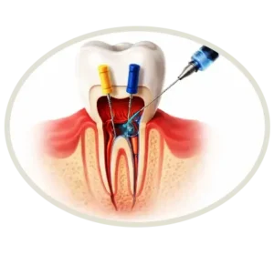 Multiroots teeth 300x279