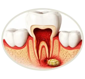 Ofoni teeth 300x279