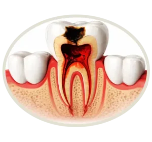 Poside teeth 300x279