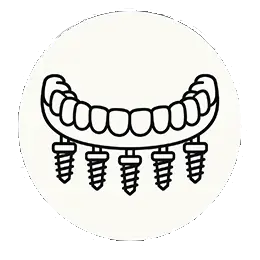 Overdenture3