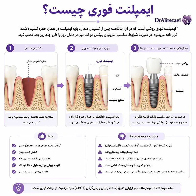 Immediate implant