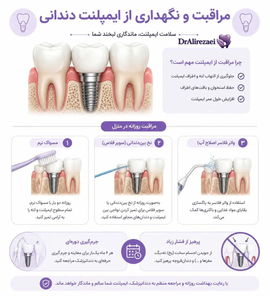 Implant care 936x1024