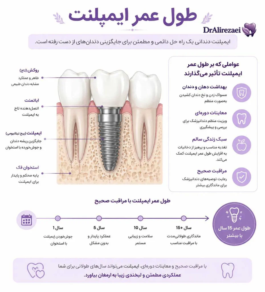 Implant lifespan 930x1024