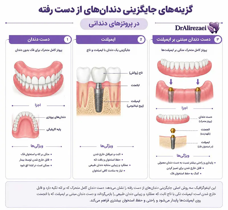 Implants or dentures